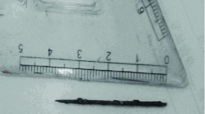 取出的繡花針已發(fā)黑生銹。