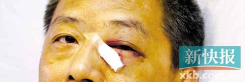 ■這起醫(yī)鬧事件，受傷的遠(yuǎn)遠(yuǎn)不只是熊旭明醫(yī)生的身體。