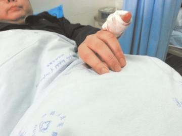 實(shí)習(xí)醫(yī)生陳洪左手的小拇指肌腱斷裂。