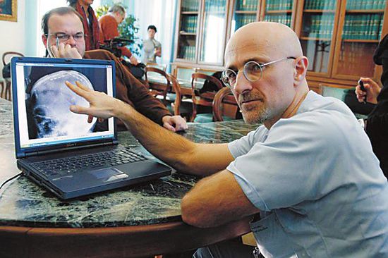 圖為卡納維洛醫(yī)生，不少人認為他的想法非常瘋狂