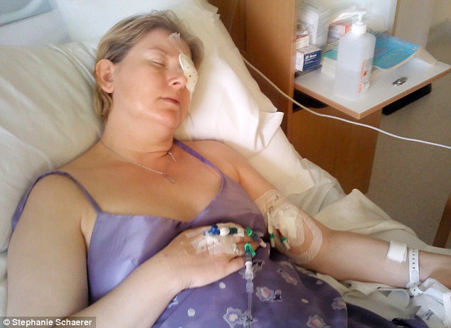 恐怖慎入！隱形眼鏡致英女子摘除眼球