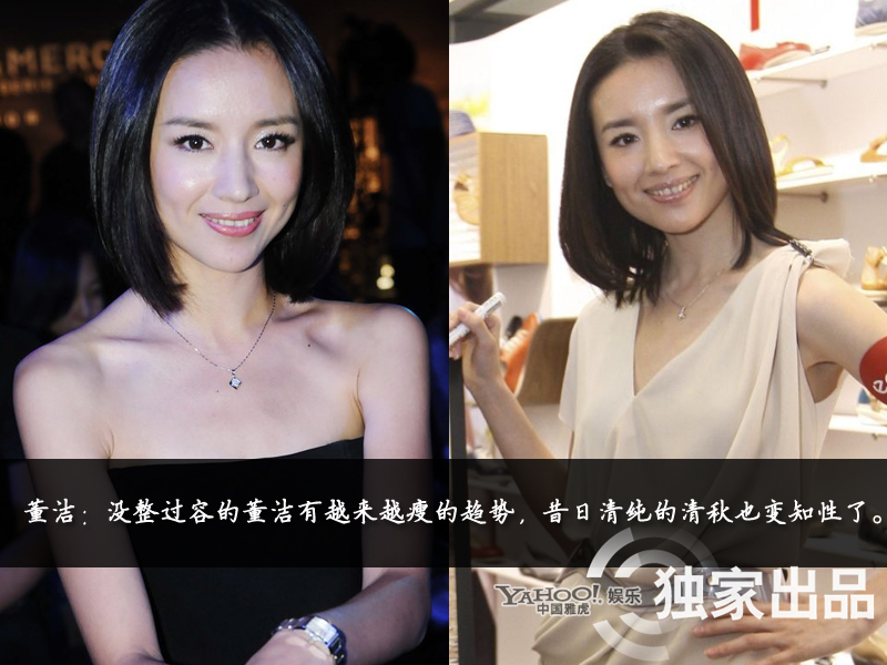 娛樂圈整容成風(fēng) 娛樂圈整容成風(fēng)