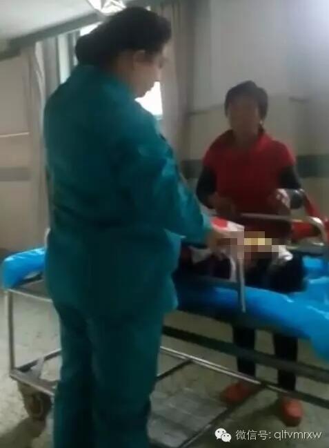 涵涵爸爸告訴《每日新聞》記者：“沒想到是熱水，大人也沒看，一時疏忽，掉進去了。抱出來的時候這個皮已經(jīng)掉了。”