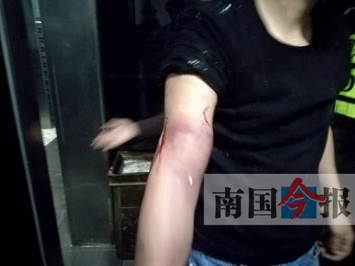 覃先生手臂被卡的部位受傷流血，所幸傷勢無大礙。 通訊員 王建民 攝