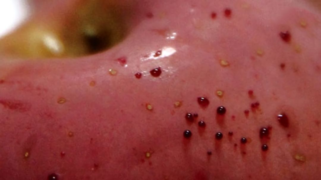 嚇懵！女子用熱水泡蘋果結(jié)果冒出血珠 咋回事？