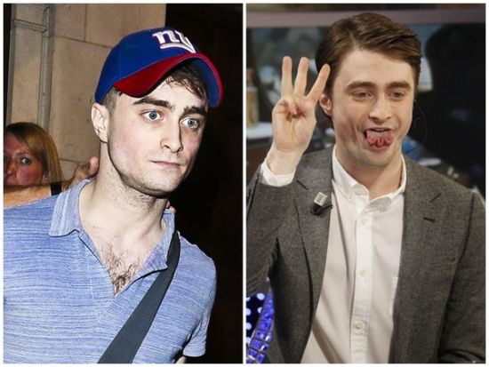 丹尼爾日前被拍到骨瘦如柴，不似2月份健康