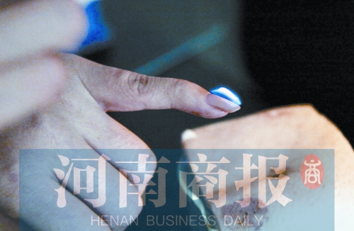 將指甲油涂在指甲上，靠近火焰時(shí)被引燃了